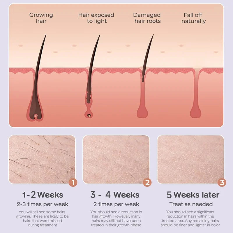 999999 Flashes IPL Laser Epilator for Women Home Use Devices Hair Removal Painless Electric Epilator Bikini Dropshipping