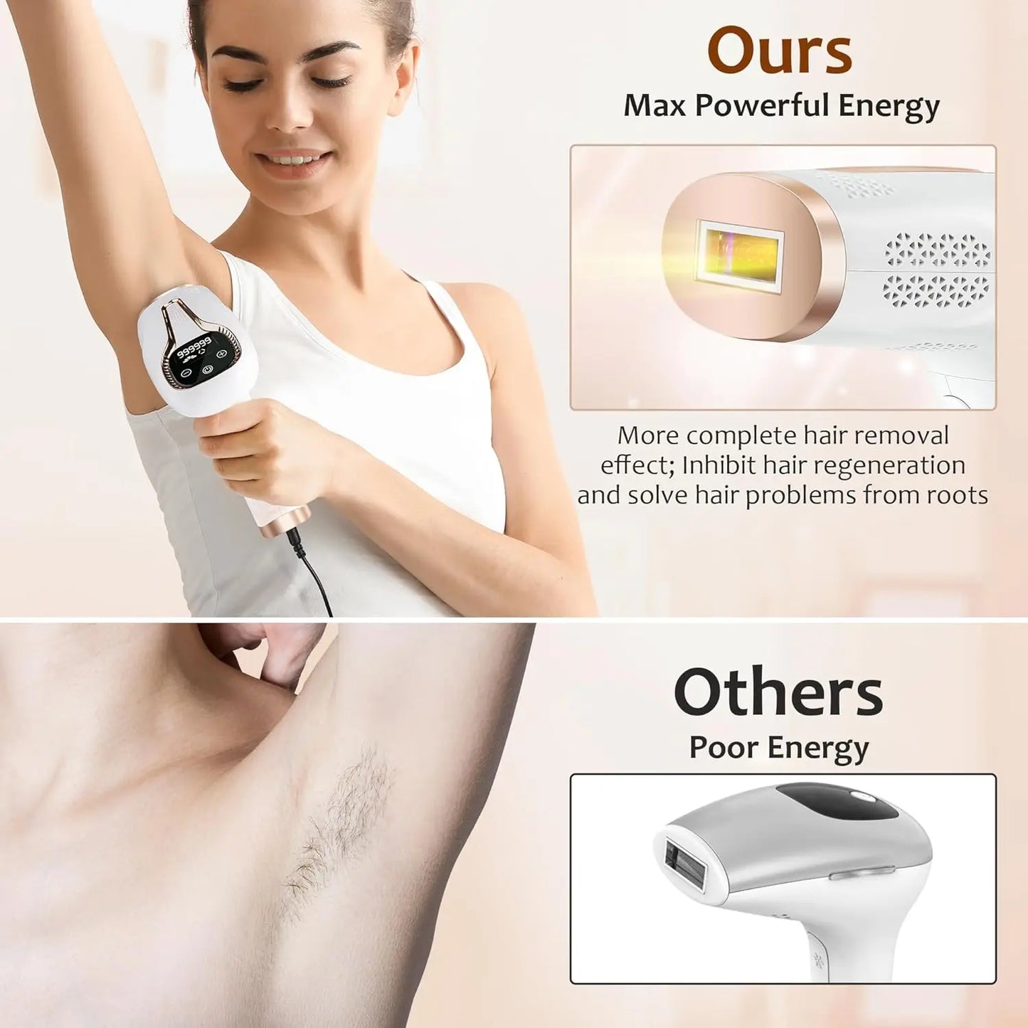 Women’S IPL Hair Removal System with 990000 Flashes Painless Laser Epilator for Home Use Body and Bikini