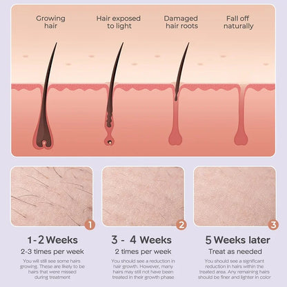 999999 Flashes IPL Laser Epilator for Women Home Use Devices Hair Removal Painless Electric Epilator Bikini Dropshipping