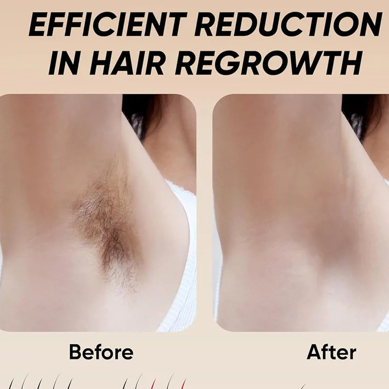 999999 Flashes IPL Laser Epilator for Women Home Use Devices Hair Removal Painless Electric Epilator Bikini Dropshipping