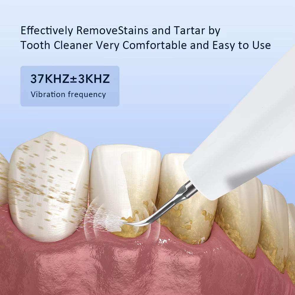 Electric Ultrasonic Dental Scaler for Effective Tartar Removal and Teeth Whitening