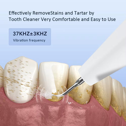 Electric Ultrasonic Dental Scaler for Effective Tartar Removal and Teeth Whitening